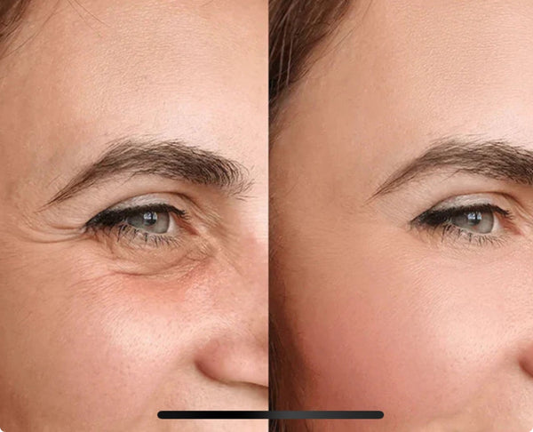Before After Image