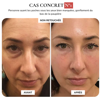 MAISON SAFIA™ : Patchs Yeux Anti-Cernes