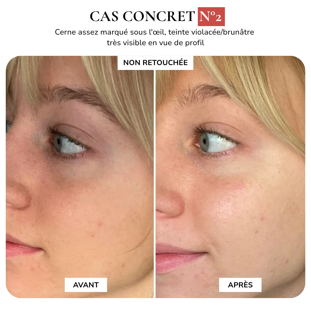 MAISON SAFIA™ : Patchs Yeux Anti-Cernes