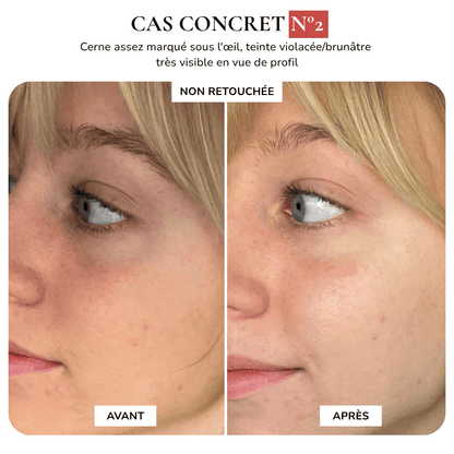 MAISON SAFIA™ : Patchs Yeux Anti-Cernes