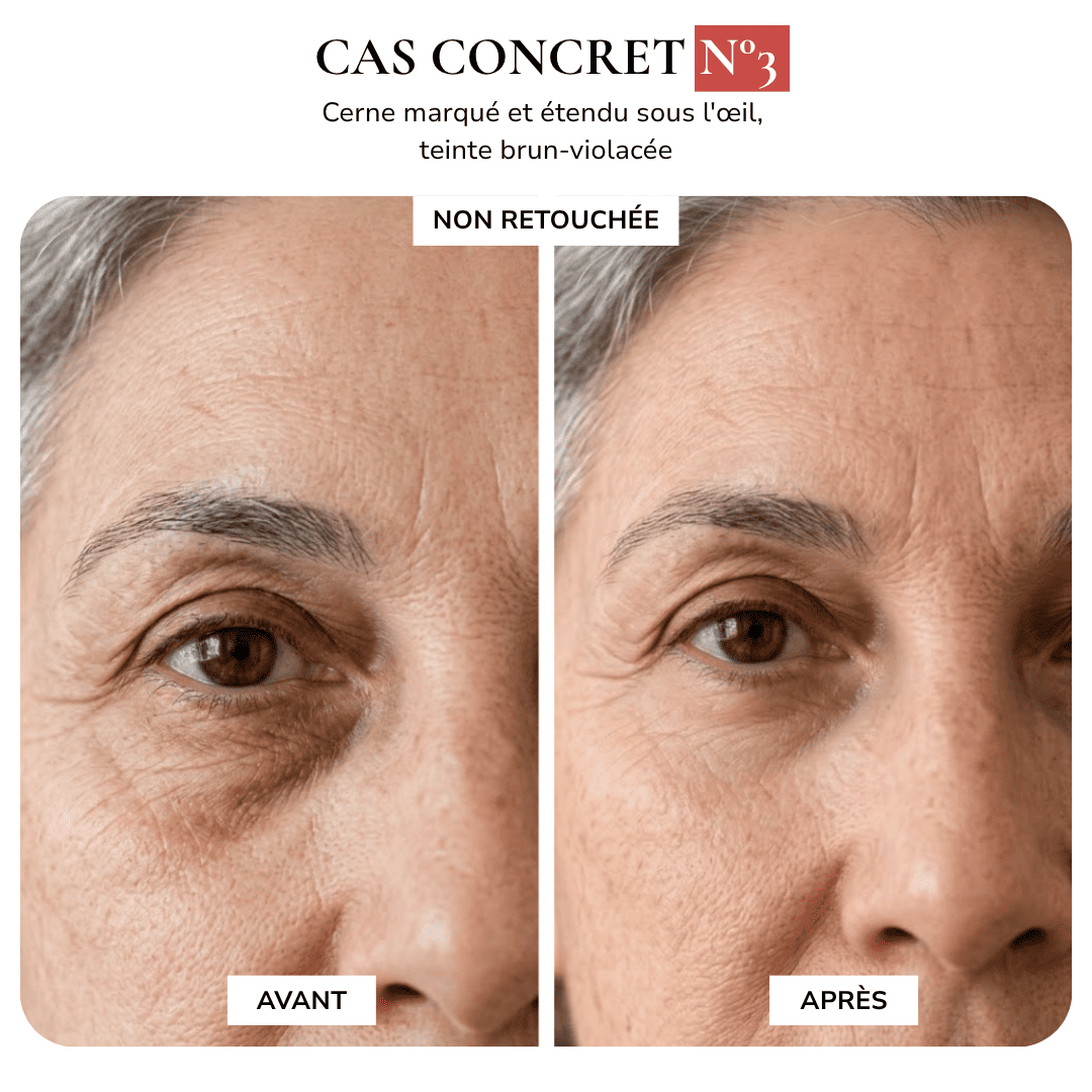 MAISON SAFIA™ : Patchs Yeux Anti-Cernes