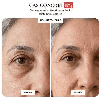 MAISON SAFIA™ : Patchs Yeux Anti-Cernes